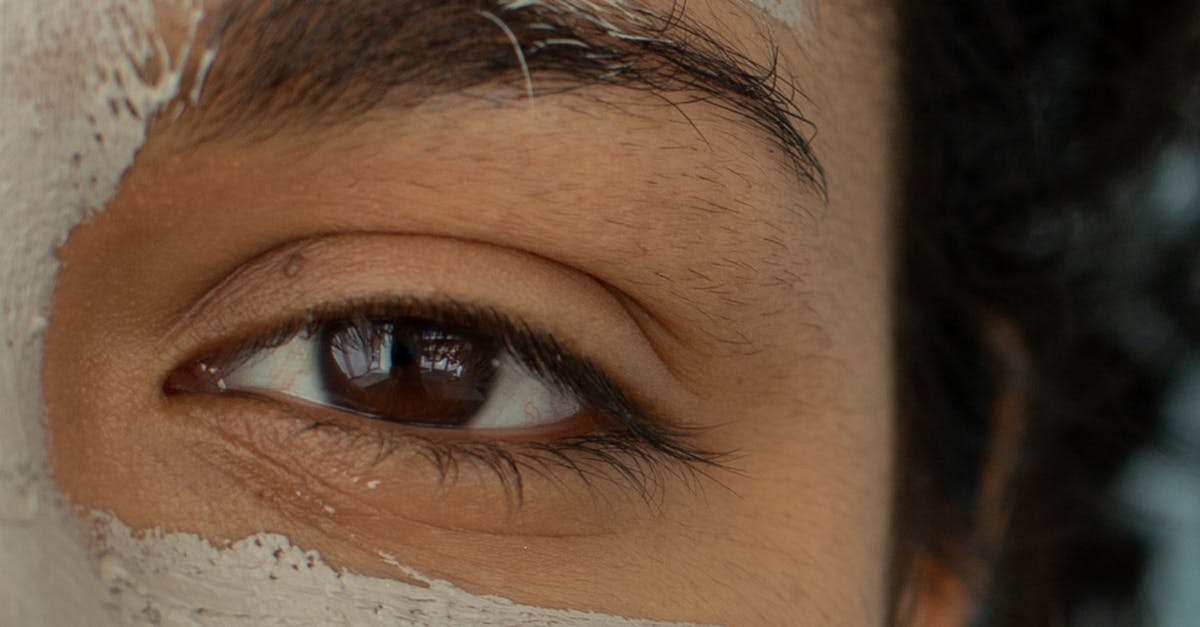 Chemical Peels for Acne Management: A Comprehensive Look