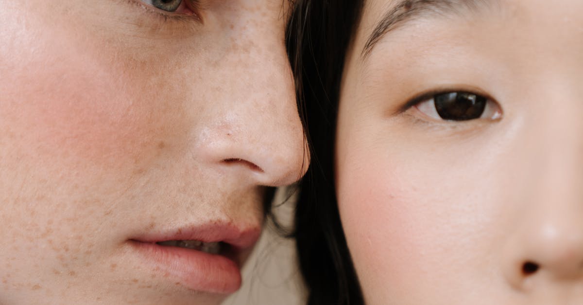 How to Choose the Right Laser Treatment for Hyperpigmentation