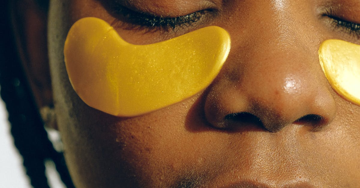 Targeting Stretch Marks with Laser Technology