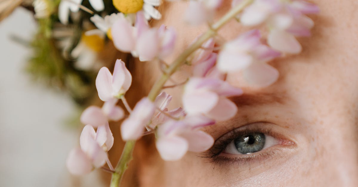 Understanding Skin Conditions Suitable for Microdermabrasion